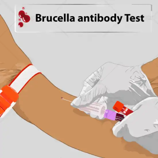 Brucella Antibody IgM Test
